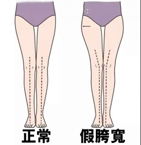 假胯寬