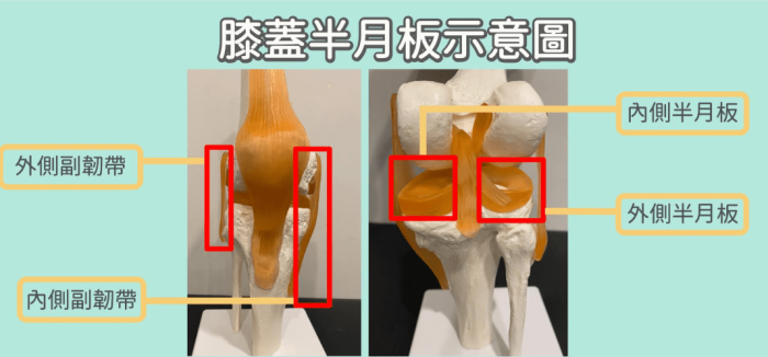 膝蓋韌帶有哪些