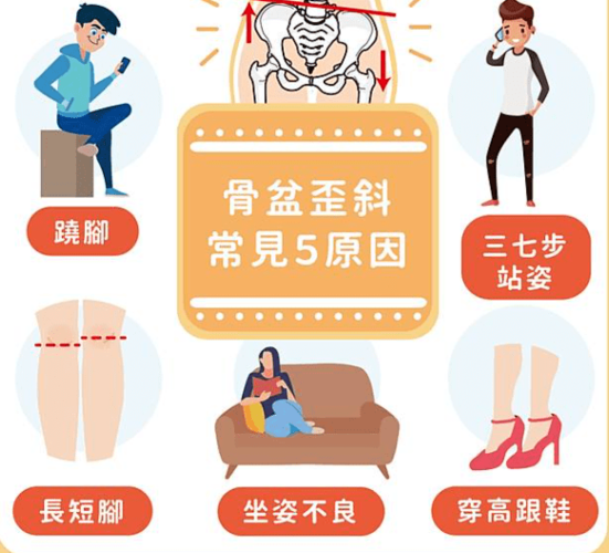 骨盆歪斜原因